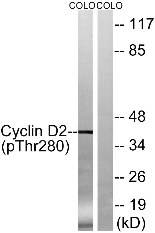 Cyclin D2 (Phospho-Thr280) Colorimetric Cell-Based ELISA Kit