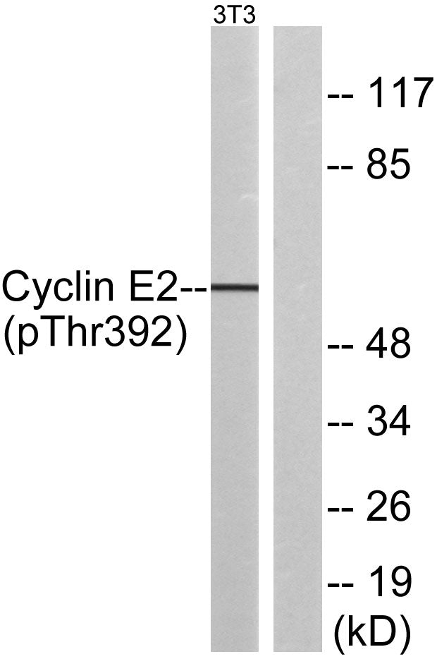 Cyclin E2 (Phospho-Thr392) Colorimetric Cell-Based ELISA Kit