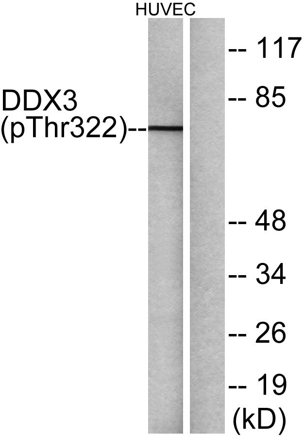 DDX3 (Phospho-Thr322) Colorimetric Cell-Based ELISA Kit