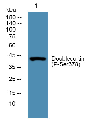 Doublecortin (Phospho-Ser378) Colorimetric Cell-Based ELISA Kit