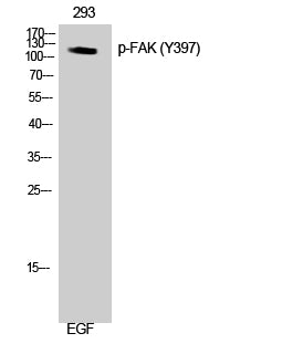 FAK (Phospho-Tyr397) Colorimetric Cell-Based ELISA Kit