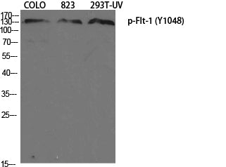 Flt-1 (Phospho-Tyr1048) Colorimetric Cell-Based ELISA Kit