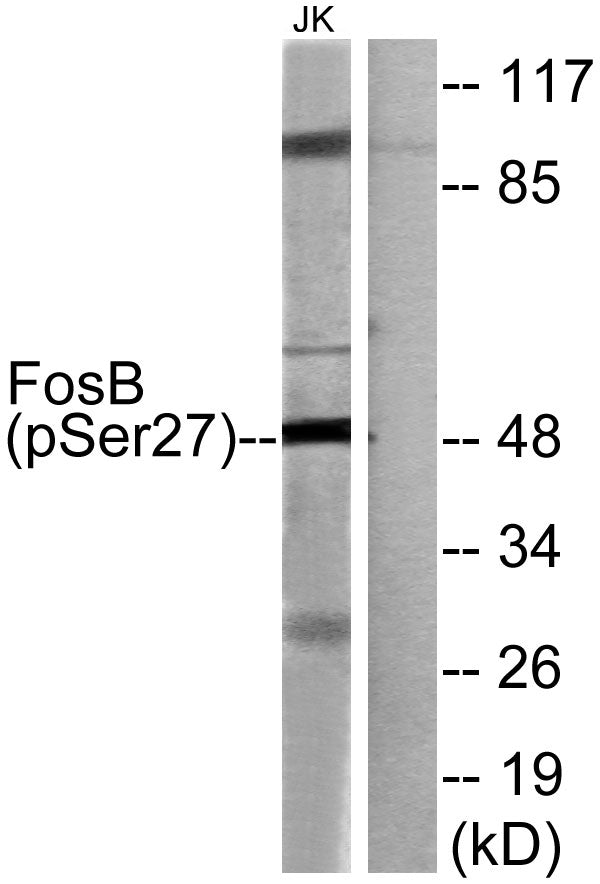 Fos B (Phospho-Ser27) Colorimetric Cell-Based ELISA Kit