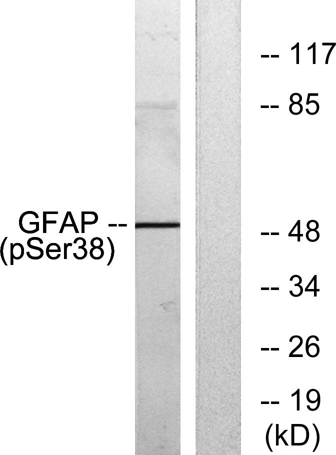GFAP (Phospho-Ser38) Colorimetric Cell-Based ELISA Kit
