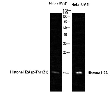 Histone H2A (Phospho-Thr121) Colorimetric Cell-Based ELISA Kit