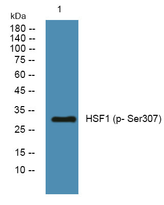 HSF1 (Phospho-Ser307) Colorimetric Cell-Based ELISA Kit