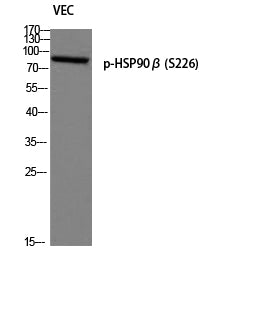 HSP90beta (Phospho-Ser226) Colorimetric Cell-Based ELISA Kit