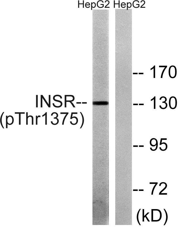 Insulin R (Phospho-Thr1375) Colorimetric Cell-Based ELISA Kit