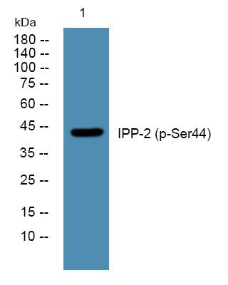 IPP-2 (Phospho-Ser44) Colorimetric Cell-Based ELISA Kit
