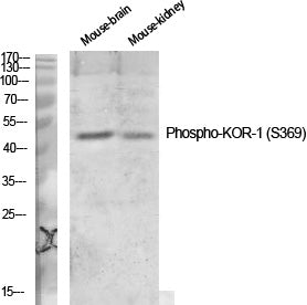KOR-1 (Phospho-Ser369) Colorimetric Cell-Based ELISA Kit