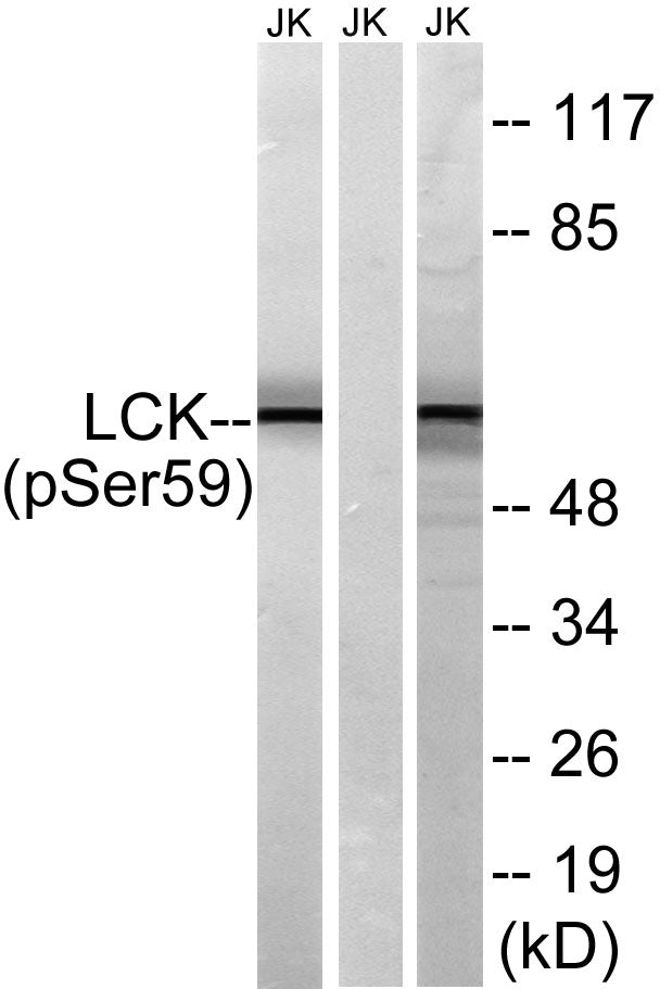 Lck (Phospho-Ser540) Colorimetric Cell-Based ELISA Kit