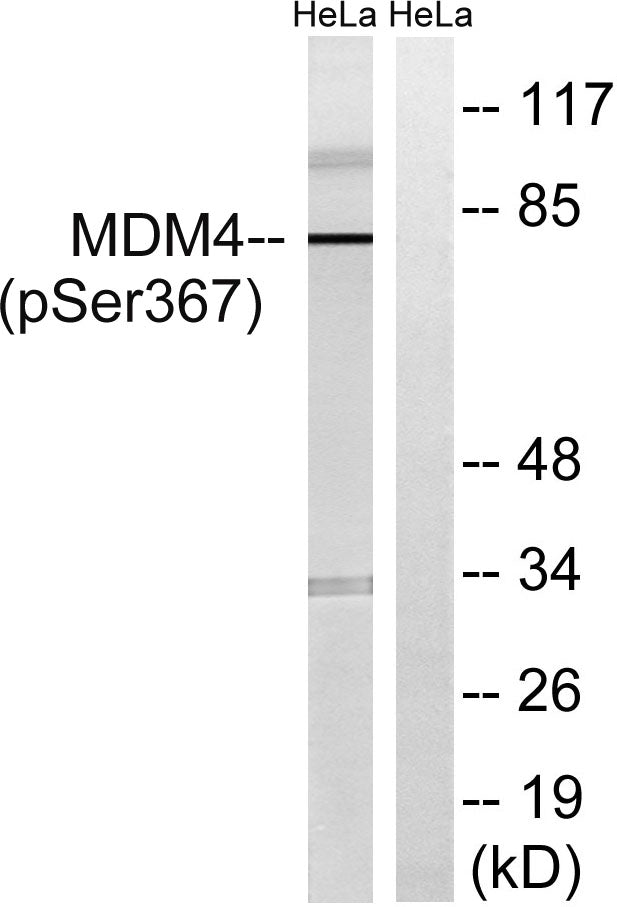 MDMX (Phospho-Ser367) Colorimetric Cell-Based ELISA Kit