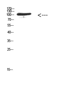 MER/TYRO3 (Phospho-Tyr753/Tyr685) Colorimetric Cell-Based ELISA Kit