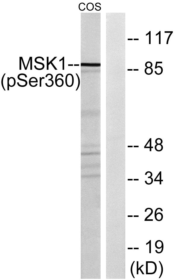 MSK1 (Phospho-Ser360) Colorimetric Cell-Based ELISA Kit