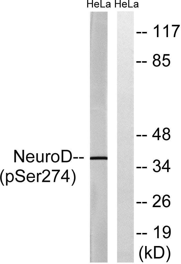 Neuro D (Phospho-Ser274) Colorimetric Cell-Based ELISA Kit
