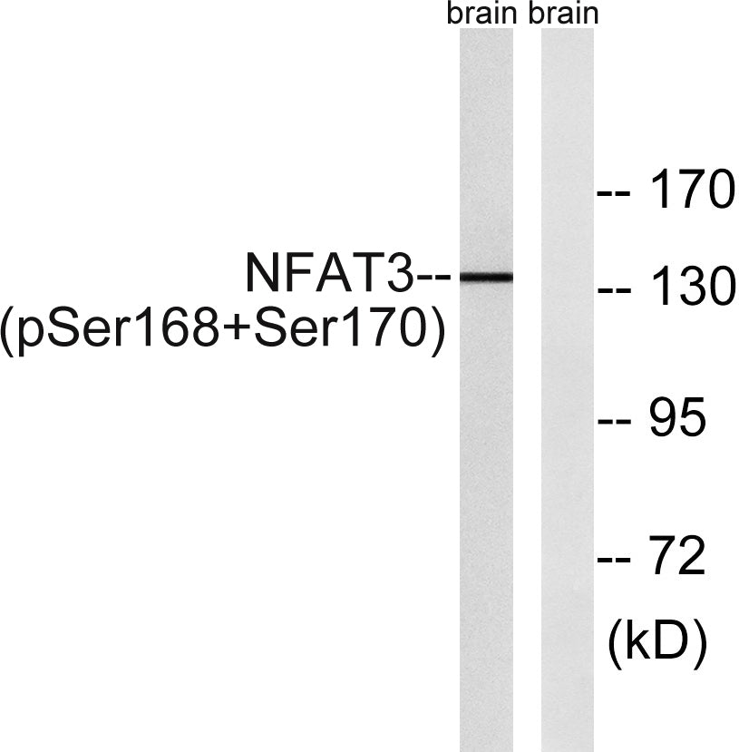 NFATc4 (Phospho-Ser168/S170) Colorimetric Cell-Based ELISA Kit
