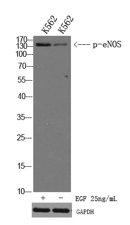 eNOS (Phospho-Ser1179) Colorimetric Cell-Based ELISA Kit