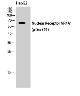 Nur77 (Phospho-Ser351) Colorimetric Cell-Based ELISA Kit