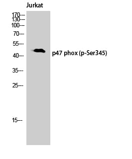 p47-phox (Phospho-Ser345) Colorimetric Cell-Based ELISA Kit