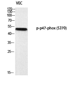 p47-phox (Phospho-Ser370) Colorimetric Cell-Based ELISA Kit
