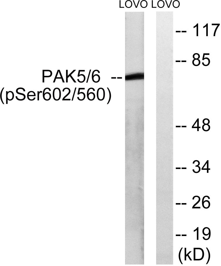 PAK5/6 (Phospho-Ser602/S560) Colorimetric Cell-Based ELISA Kit