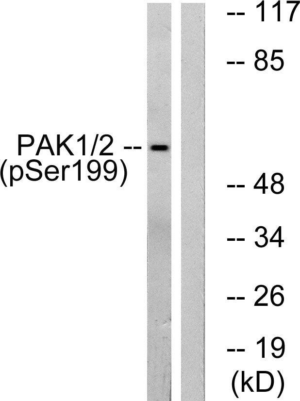 PAKalpha (Phospho-Ser199) Colorimetric Cell-Based ELISA Kit
