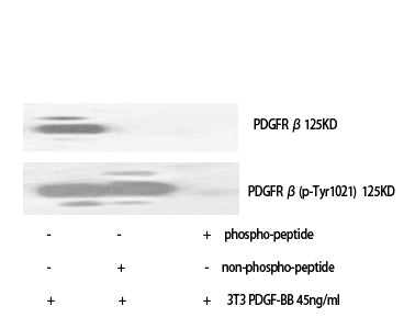 PDGFR-beta (Phospho-Tyr1021) Colorimetric Cell-Based ELISA Kit