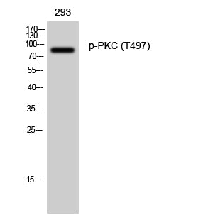 PKC (Phospho-Thr497) Colorimetric Cell-Based ELISA Kit