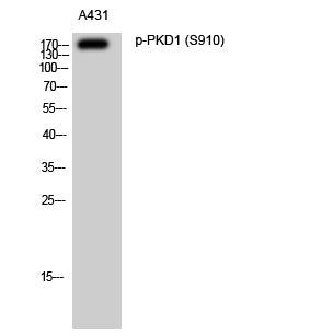 PKD1 (Phospho-Ser910) Colorimetric Cell-Based ELISA Kit