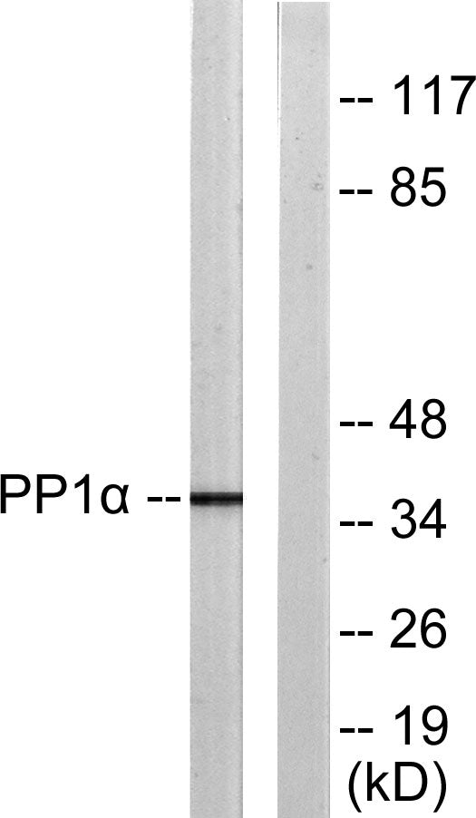 PP1alpha (Phospho-Thr320) Colorimetric Cell-Based ELISA Kit