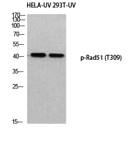 Rad51 (Phospho-Thr309) Colorimetric Cell-Based ELISA Kit
