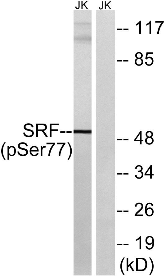 SRF (Phospho-Ser77) Colorimetric Cell-Based ELISA Kit