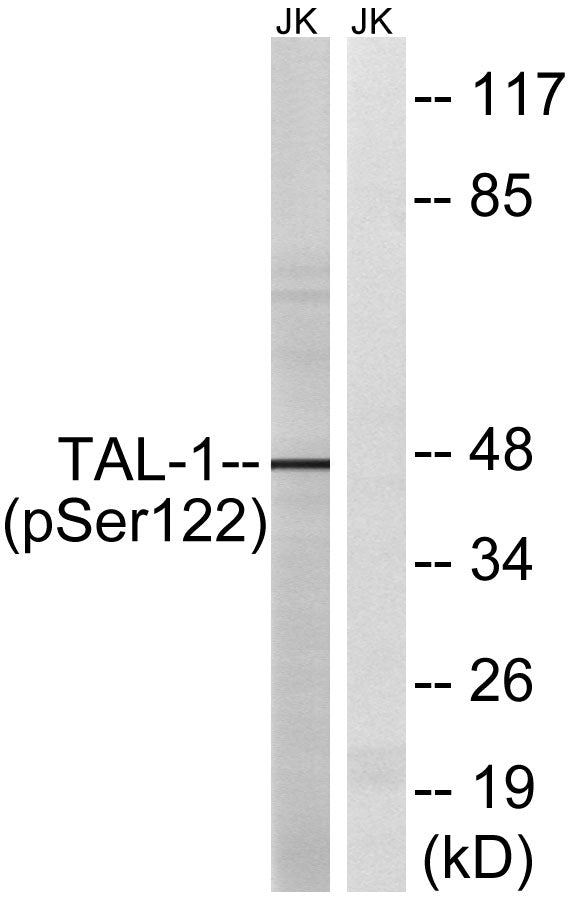 TAL1 (Phospho-Ser122) Colorimetric Cell-Based ELISA Kit