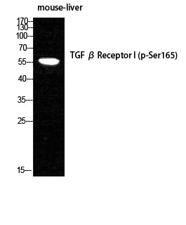 TGFbeta RI (Phospho-Ser165) Colorimetric Cell-Based ELISA Kit