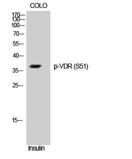 VDR (Phospho-Ser51) Colorimetric Cell-Based ELISA Kit