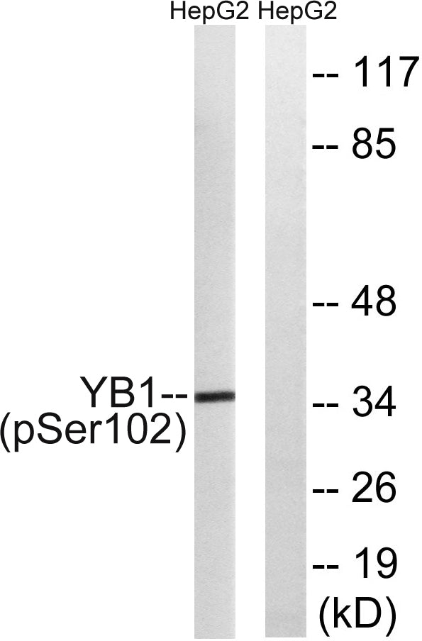 YB-1 (Phospho-Ser102) Colorimetric Cell-Based ELISA Kit