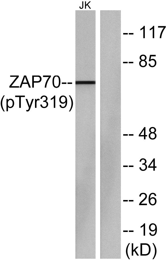 ZAP-70 (Phospho-Tyr319) Colorimetric Cell-Based ELISA Kit