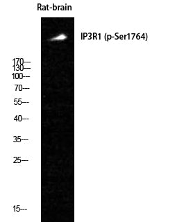 IP3R-I (Phospho-Ser1764) Colorimetric Cell-Based ELISA Kit