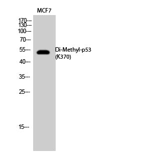 p53 (Di Methyl-Lys370) Colorimetric Cell-Based ELISA Kit