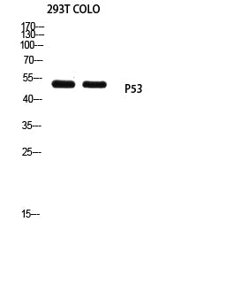 p53 (Mono Methyl-Lys370) Colorimetric Cell-Based ELISA Kit