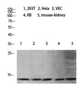 Histone H4 (Mono Methyl-Lys21) Colorimetric Cell-Based ELISA Kit