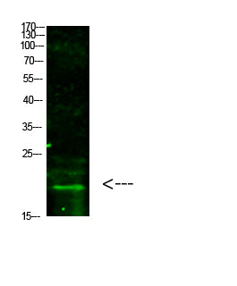 Histone H3 (Tri-Methyl-K5) Colorimetric Cell-Based ELISA Kit