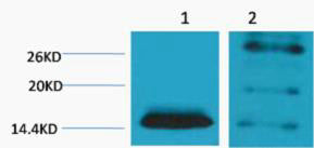 Histone H2B (Di Methyl-Lys5) Colorimetric Cell-Based ELISA Kit