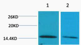 Histone H2B (Di Methyl-Lys43) Colorimetric Cell-Based ELISA Kit