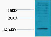 Histone H3 (Di Methyl-Lys18) Colorimetric Cell-Based ELISA Kit
