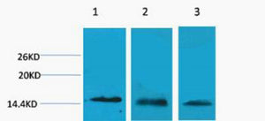 Histone H3 (Tri Methyl-Lys27) Colorimetric Cell-Based ELISA Kit