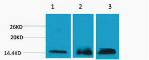 Histone H3 (Tri Methyl-Lys36) Colorimetric Cell-Based ELISA Kit