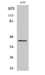 Cleaved-MMP-3 (F100) Colorimetric Cell-Based ELISA Kit