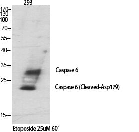 Cleaved-Caspase-6 p18 (D179) Colorimetric Cell-Based ELISA Kit