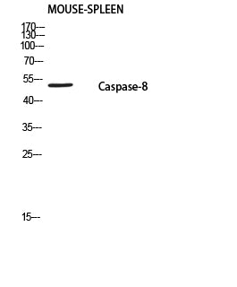 Cleaved-Caspase-8 p18 (S217) Colorimetric Cell-Based ELISA Kit